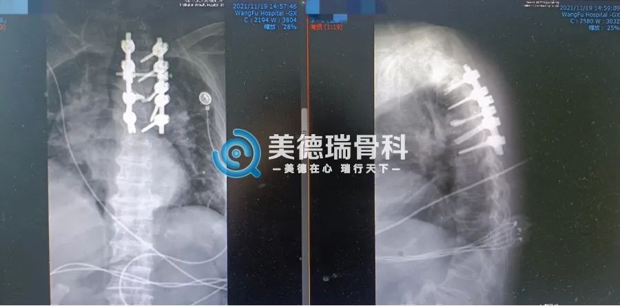 北京王府医院美德瑞骨科中心