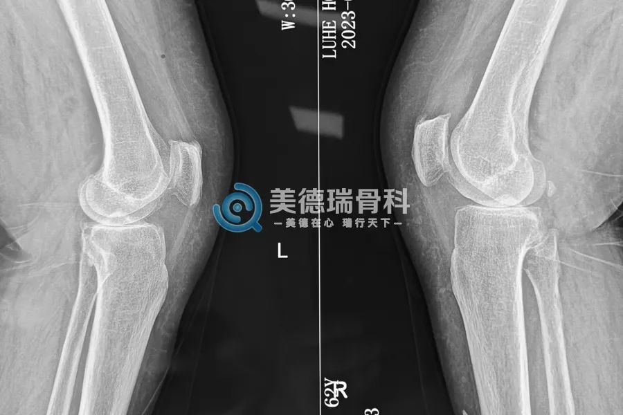 北京王府医院美德瑞骨科中心