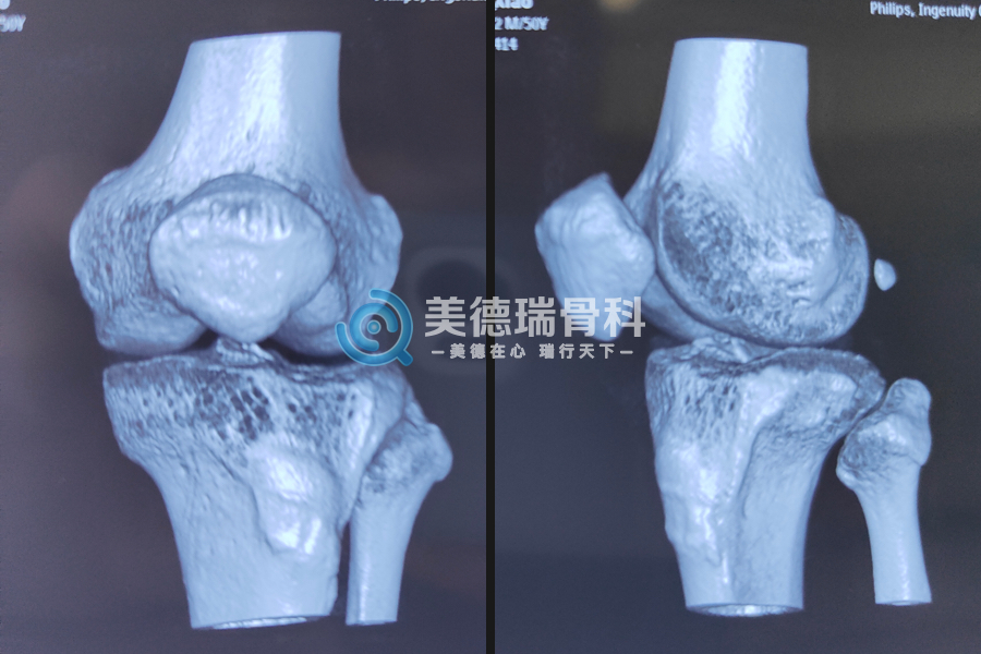 北京王府医院美德瑞骨科中心