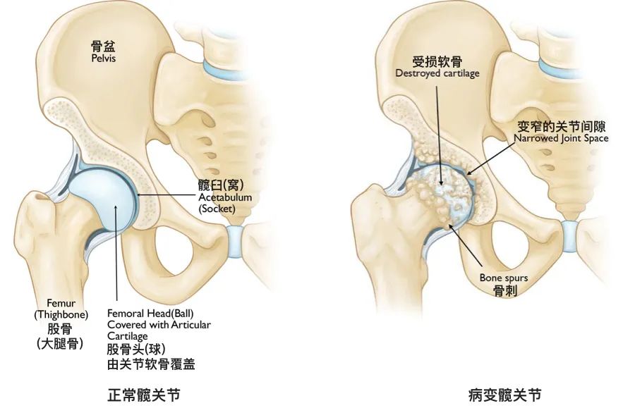 髋关节