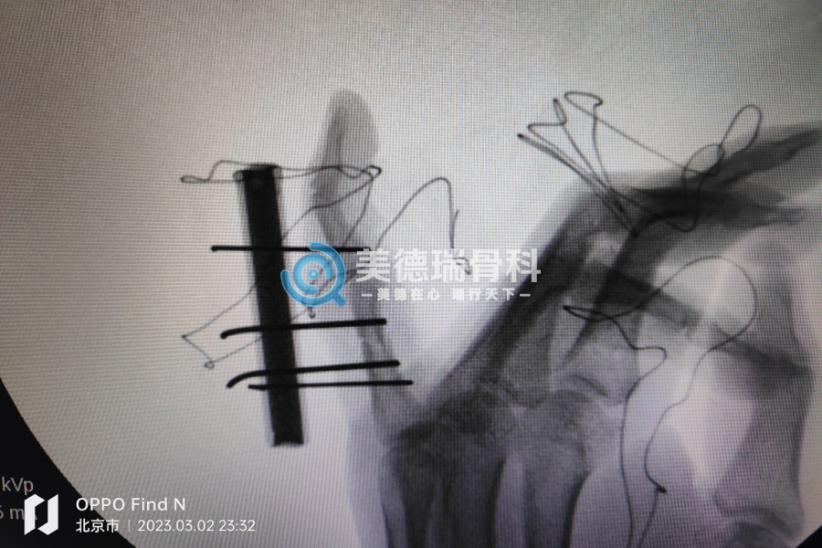 北京王府医院美德瑞骨科中心