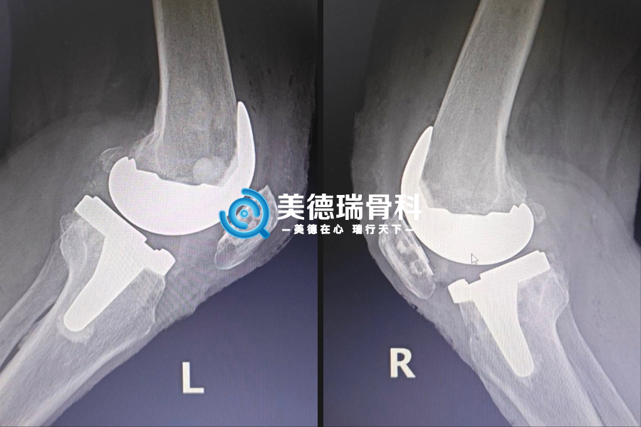 淄博市妇幼保健院美德瑞骨科中心