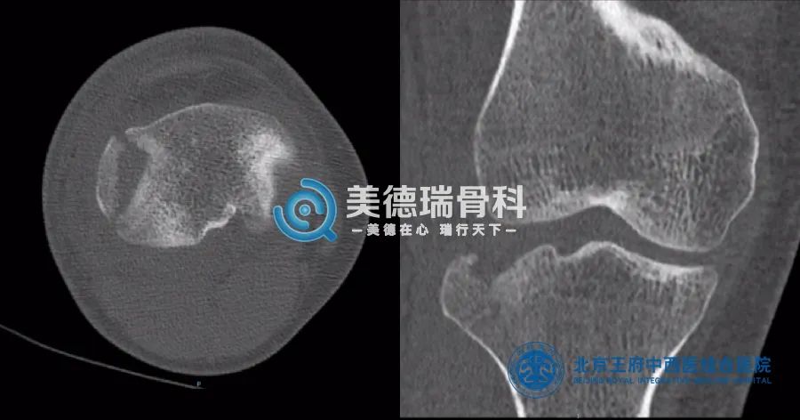 北京王府医院美德瑞骨科中心