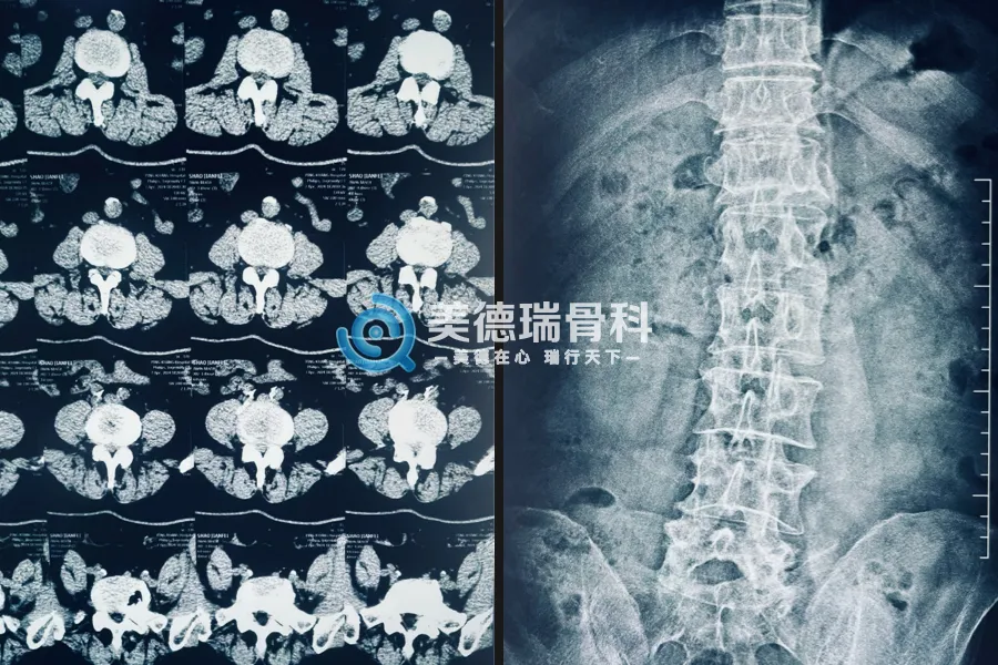 平庄矿区总医院美德瑞骨科中心