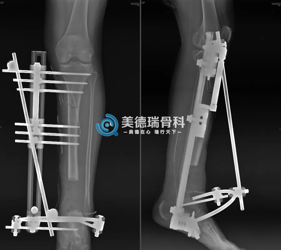 北京王府医院美德瑞骨科中心