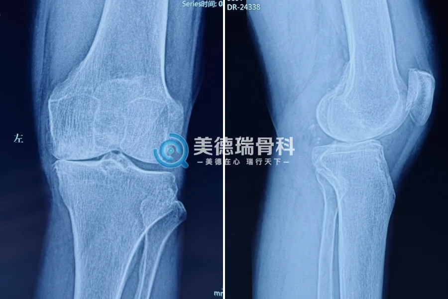 北京红十字会和平骨科医院美德瑞关节脊柱中心