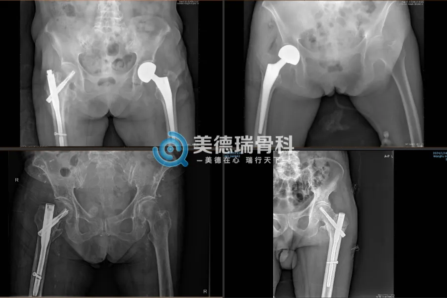 北京王府医院美德瑞骨科中心