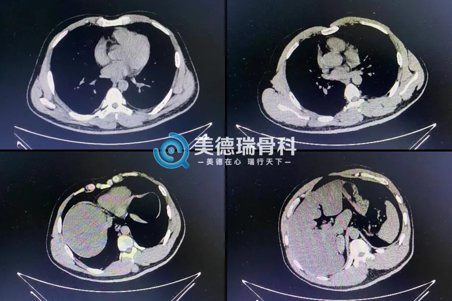 北京王府医院美德瑞骨科中心