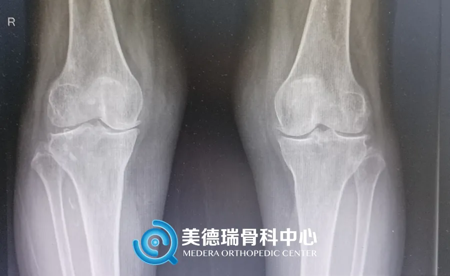 北京美德瑞骨科医生集团