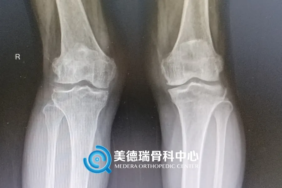 北京王府医院美德瑞骨科中