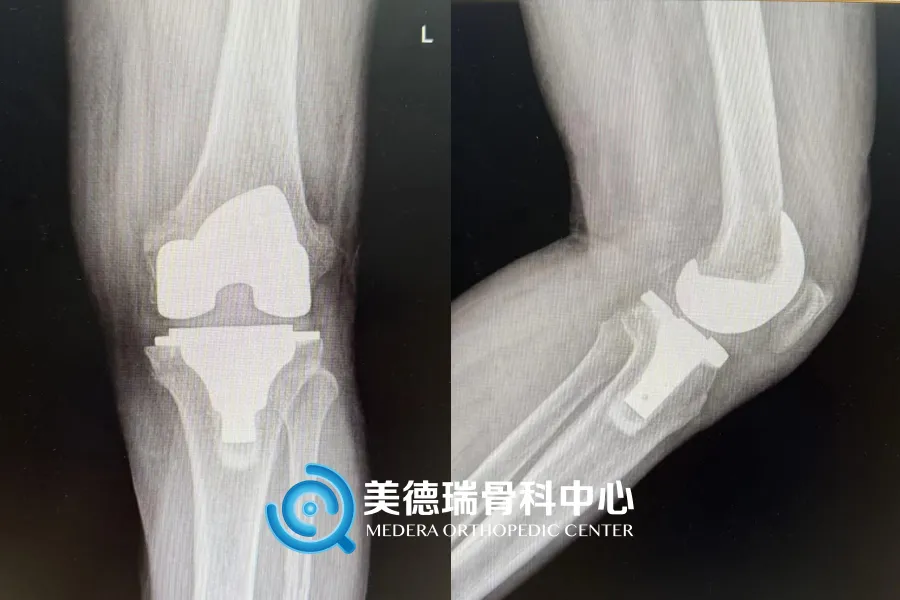 北京王府医院美德瑞骨科中