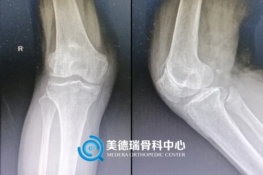 北京王府医院美德瑞骨科中