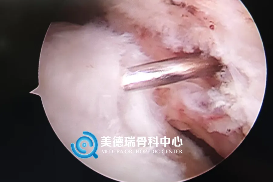 北京美德瑞骨科医生集团