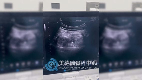北京红十字会和平骨科医院美德瑞关节脊柱中心