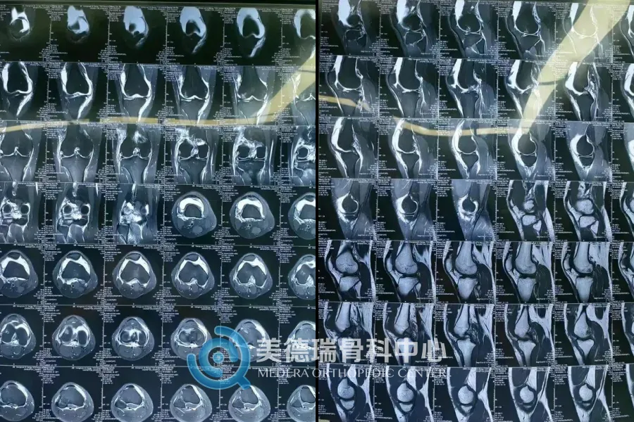 北京美德瑞骨科医生集团
