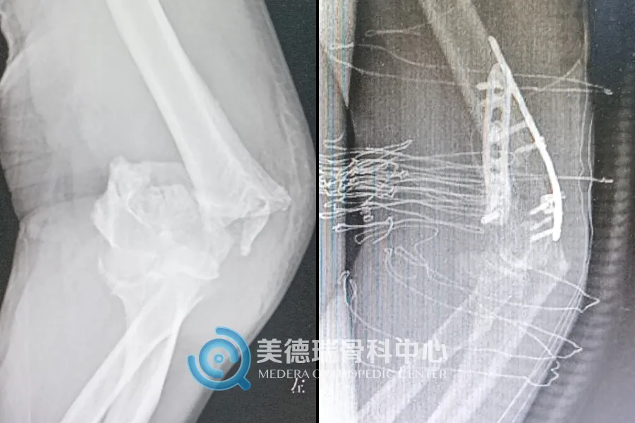 北京美德瑞骨科医生集团