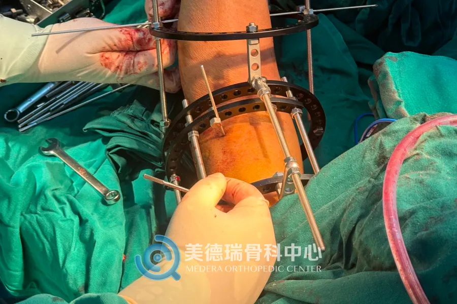 北京美德瑞骨科医生集团