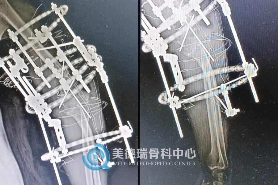 北京美德瑞骨科医生集团