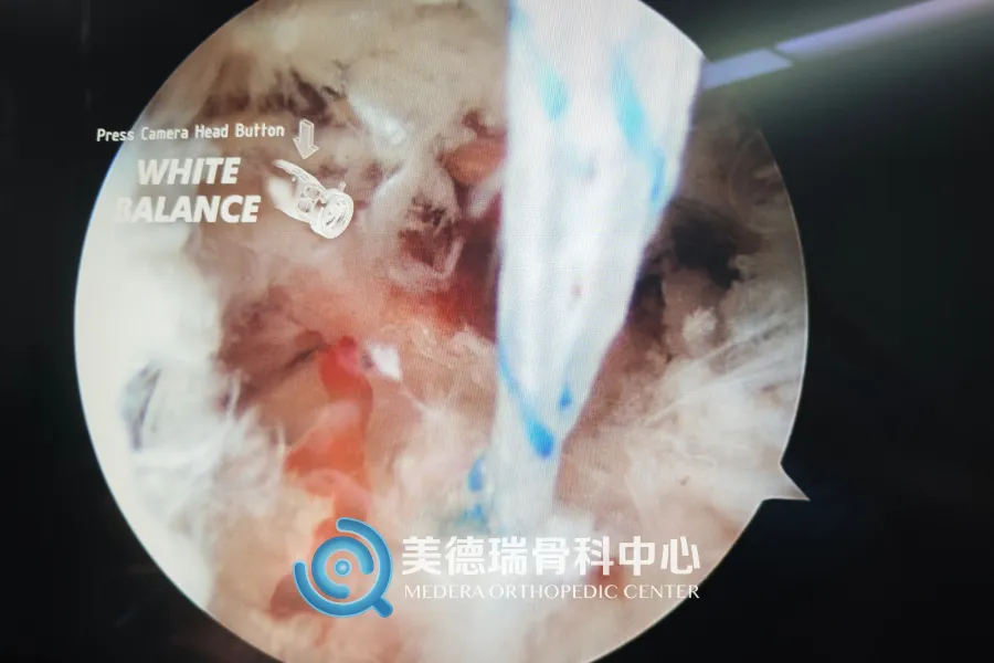 平庄矿区总医院美德瑞骨科中心