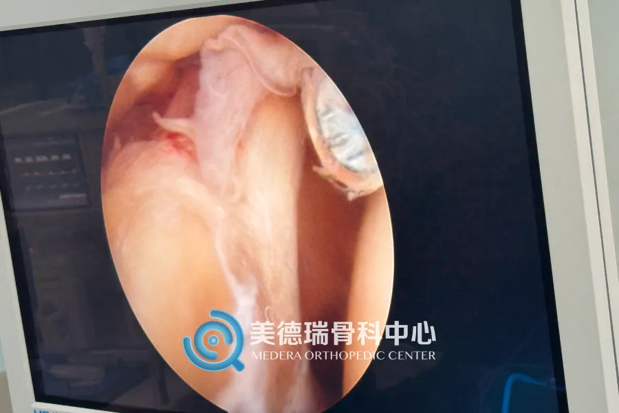 平庄矿区总医院美德瑞骨科中心