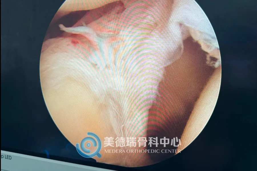 平庄矿区总医院美德瑞骨科中心