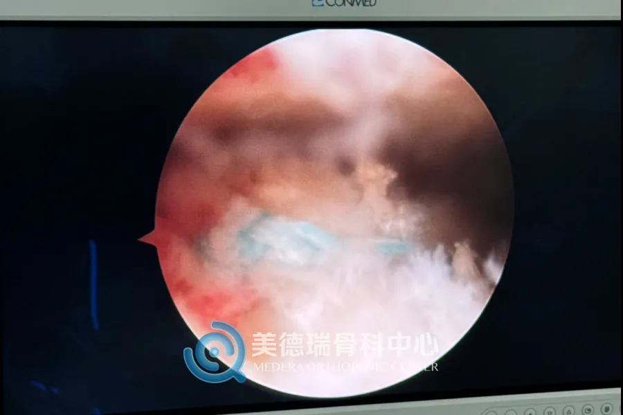 平庄矿区总医院美德瑞骨科中心
