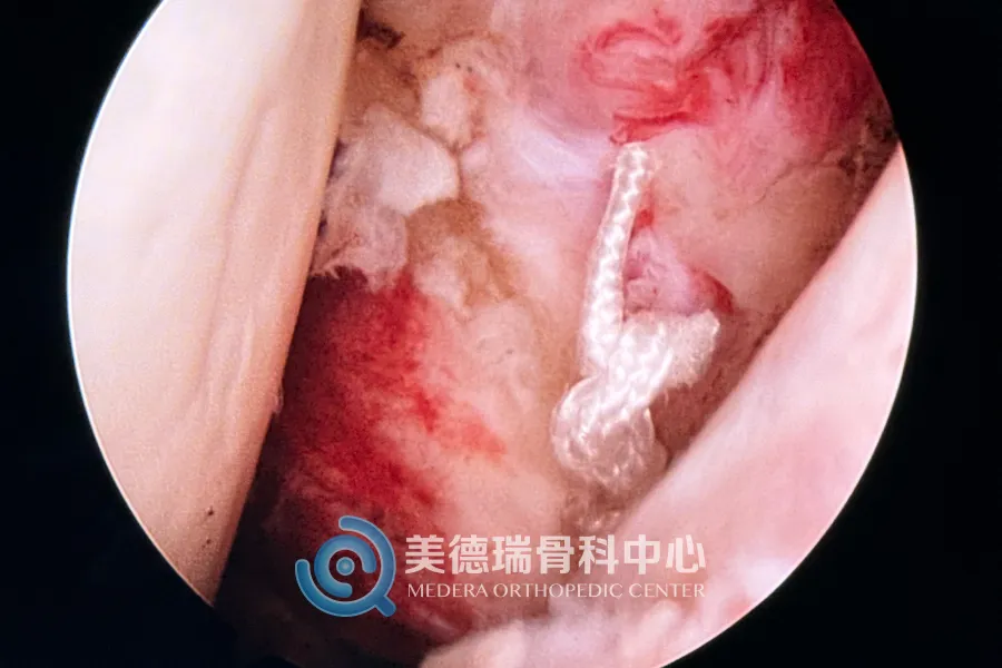 平庄矿区总医院美德瑞骨科中心