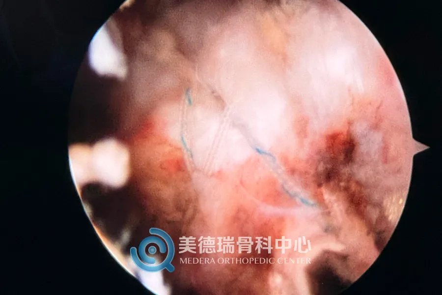 平庄矿区总医院美德瑞骨科中心