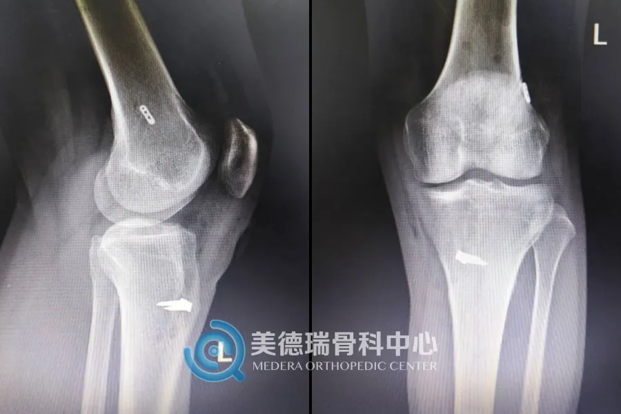 淄博市妇幼保健院美德瑞关节脊柱中心