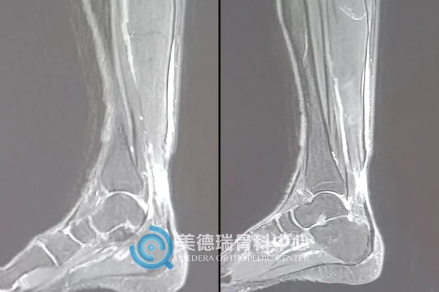 北京王府医院美德瑞骨科中心